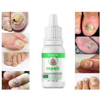 Repair Nail Fungus Treatment Serum Toe Fungal Repair Products Hand Foot Care Removal Gel Anti Infection Onychomycosis Paronychia
