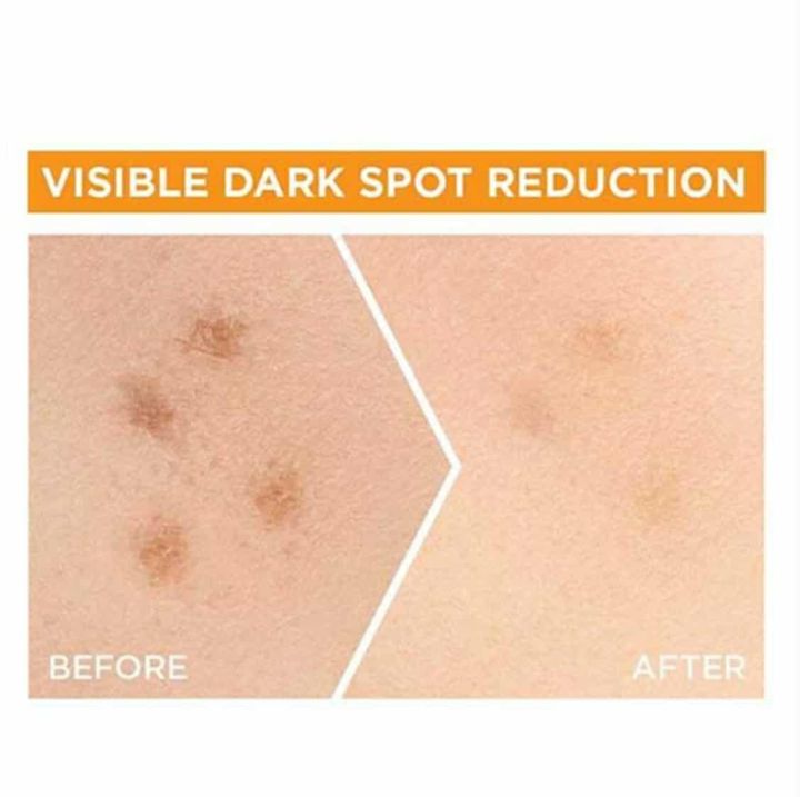 Garnier%20Bright%20Complete%20Vitamin%20C%20Serum%2015ml%20-%20Face%20Serum%20-%20Image%205