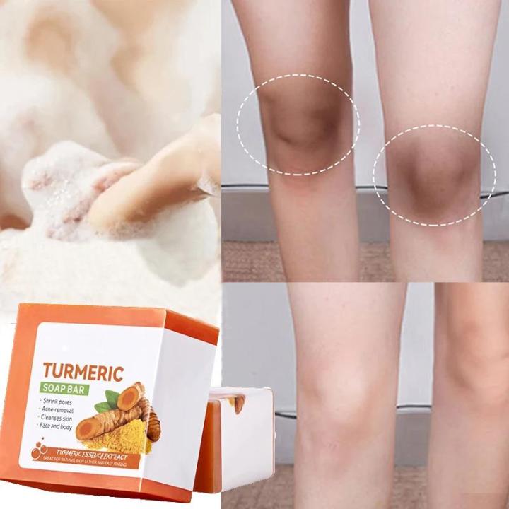 Hand%20Made%20Turmeric%20Soap%20Body%20Cleaning%20Lightening%20Dark%20Underarm%20Leg%20Body%20Cleansers%20Brightening%20Face%20Soap%20Tender%20Skin%20Care%20Beauty%20-%20Image%203