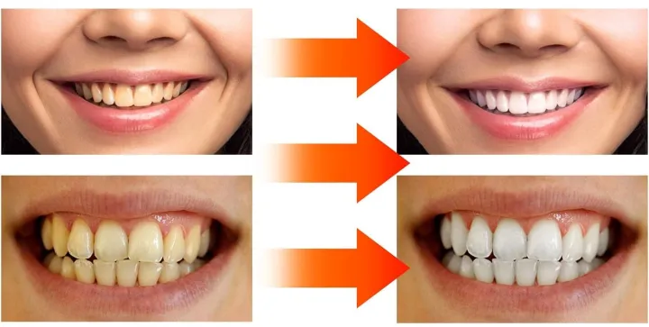 SP-10%20Probiotic%20Toothpaste,%20Deep%20Cleaning%20Care%20Toothpaste,%20New%20Sp10%20Whitening%20Toothpaste,%20SP-10%20Toothpaste%20for%20Fresh%20Breath,%20Strong%20Teeth%20Protection,Better%20-%20Image%206