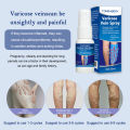 Varicose Veins Spray Medicine Spider Veins Relief Vasculitis Phlebitis Spider Pain Relief Plaster Care 30ml. 