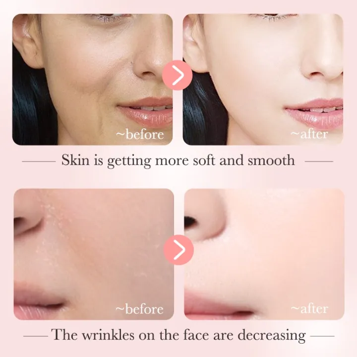 %E3%80%BD%EF%B8%8F%20Bioaqua%20Nicotinamide%20Serum%20Dispel%20Freckle%20Whitening%20Stable%20Soothing%20Essence%20%20-%2030ml%20-%20Image%202