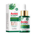 Tea Tree Acne Downplay Serum Effective Acne Reduce Repair Spots Scar Moisturizing Oil Control Shrink Pore Skin Care.