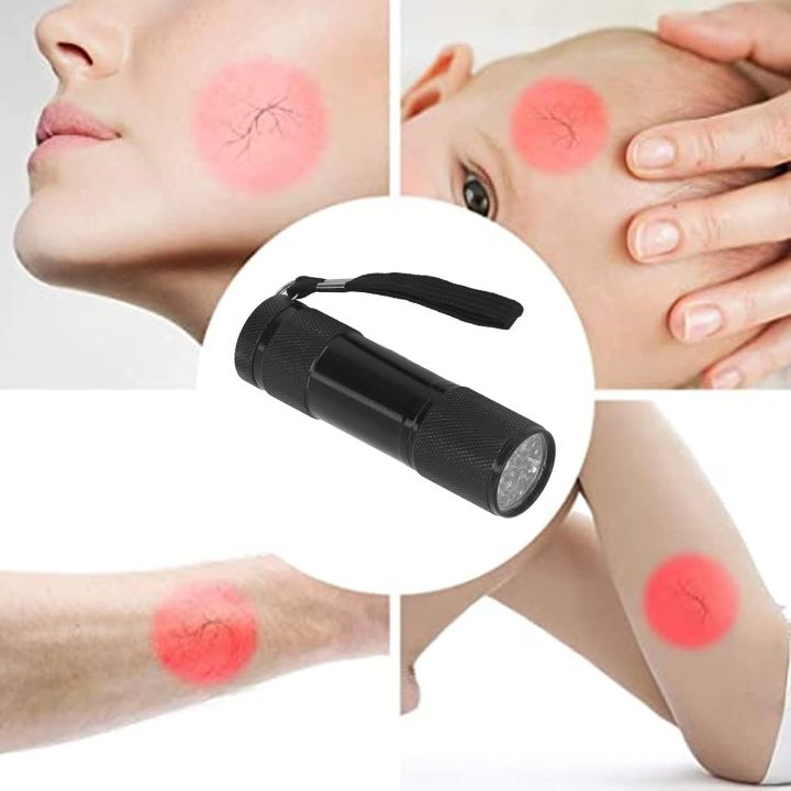 Vein%20Finder,%20Red%20Light,%20Handheld%20LED%20Vein%20Lamp,%20Infusion%20Vein%20Viewer%20Locator,%20for%20EMTs,%20Paramedics%20and%20Firefighters%20Performing%20IV%20Access%20on%20Patients%20-%20Image%203