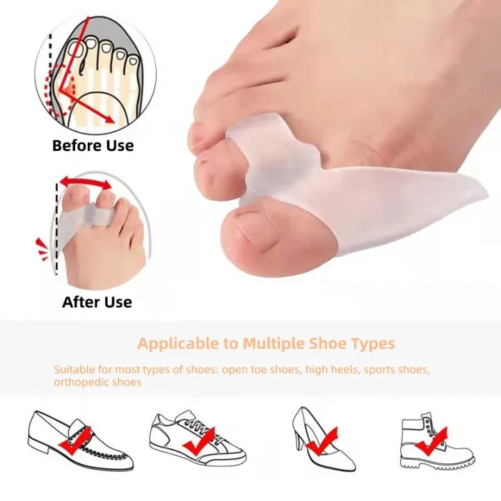 10Pairs%20Gel%20Hammer%20Toe%20Splitter%20Separators%20Silicone%20Overlapping%20Feet%20Care%20Hallux%20Valgus%20Orthopedic%20Bunion%20Corrector%20Protetor%20-%20Image%203