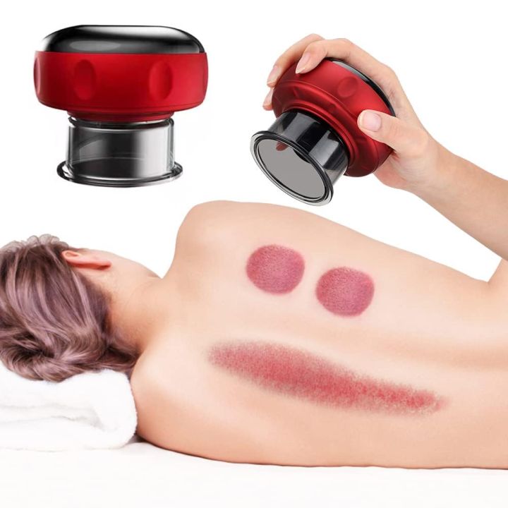 Smart%20Dynamic%20Electric%20Cupping%20Device%20-%205%20Massage%20Modes%20with%20Heating%20Therapy,%20Full%20Body%20Vacuum%20Suction%20Detox%20Massage%20Machine%20Tools%20-%20Image%207