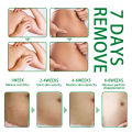 Jaysuing Pregnancy Repair Spray Fade Pregnant Women Pregnancy Fine Lines Postpartum Skin Pregnancy Lines Care Spray. 
