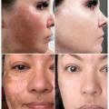 BataBata Whitening Freckles Cream Effective Remove Melasma Dark Spots Fade Pigmentation Moisturize Smooth Brighten Face Skin Care Product. 