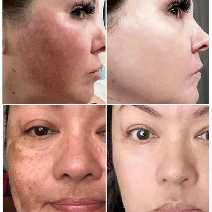 BataBata%20Whitening%20Freckles%20Cream%20Effective%20Remove%20Melasma%20Dark%20Spots%20Fade%20Pigmentation%20Moisturize%20Smooth%20Brighten%20Face%20Skin%20Care%20Product%20-%20Image%204