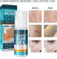 Jaysuing Advanced Scar Gel - 50ml. 