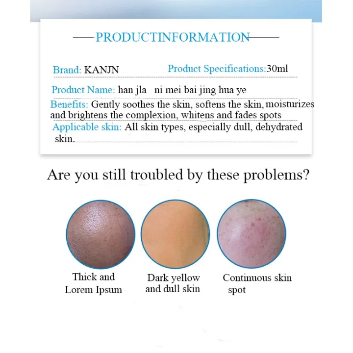 melasma%20and%20pekas%20remover%20serum,Nature%20dark%20spot%20remover%20for%20face,freckle%20remover%20cream%20anti%20aging%20cream%20-%20Image%204