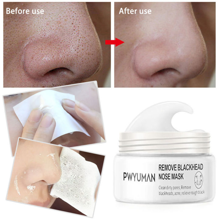 Blackhead%20Remover%20Nose%20Mask%20Pore%20Strips%20Peeling%20Acne%20Treatment%20Deep%20Cleansing%20Face%20Mask%20Oil%20Control%20Pores%20Shrinking%20Skin%20Care%20-%20Image%203