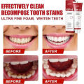 Sip-4 Probiotic Whitening Toothpaste Brightening & Stain Removing Sp-4 Probiotic Toothpaste Fresh Breath Teeth Whiten Toothpaste. 