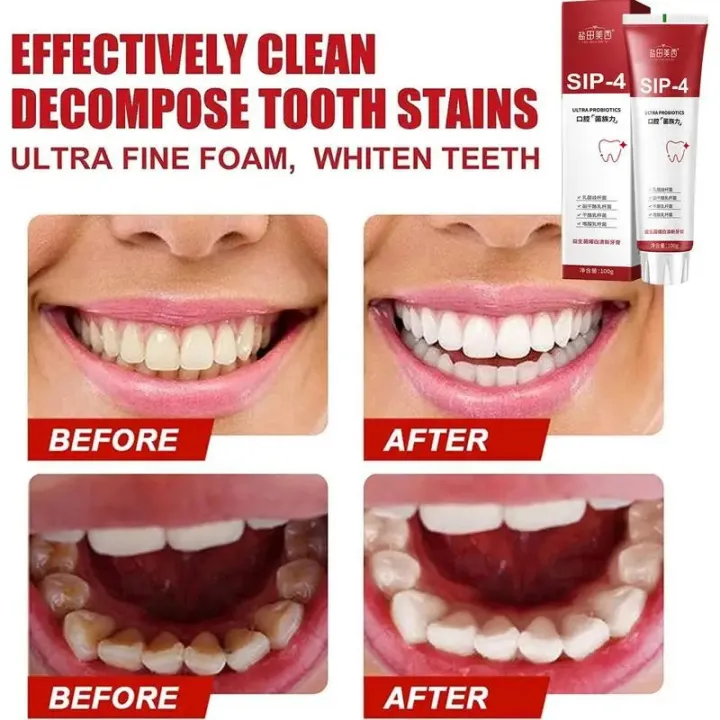 Sip-4%20Probiotic%20Whitening%20Toothpaste%20Brightening%20&%20Stain%20Removing%20Sp-4%20Probiotic%20Toothpaste%20Fresh%20Breath%20Teeth%20Whiten%20Toothpaste%20-%20Image%204