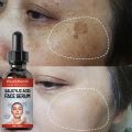 Niacinamida Whitening Face Serum Freckles Dark Spot Remover Salicylic Acid Pore Shrink Moisturizing Korean Skin Care Product30ml. 