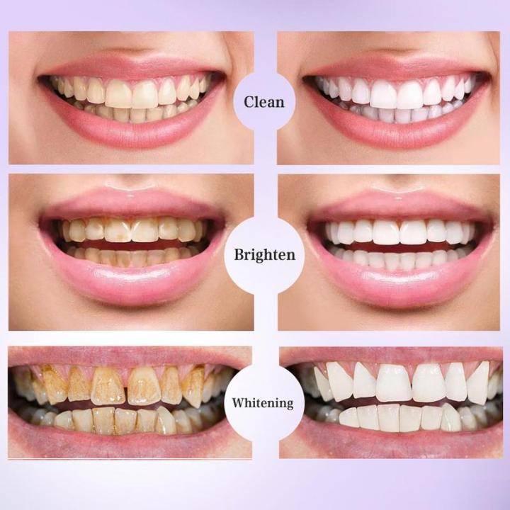 V34%20Intensive%20Teeth%20Whitener%2030ml%20Dental%20Stain%20Removal%20Yellow%20Colour%20Corrector%20Toothpaste%20Deep%20Cleaning%20Oral%20Cleaning%20Hygiene%20-%20Image%205