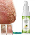 EELHOE Anti Crack Foot Hand Gel Ginger Cuticles Care Anti-Drying Healing Crack Frost Mask Dead Skin Removal Deep Moisturizing Feet Crack Whitening Smooth Feet Care.