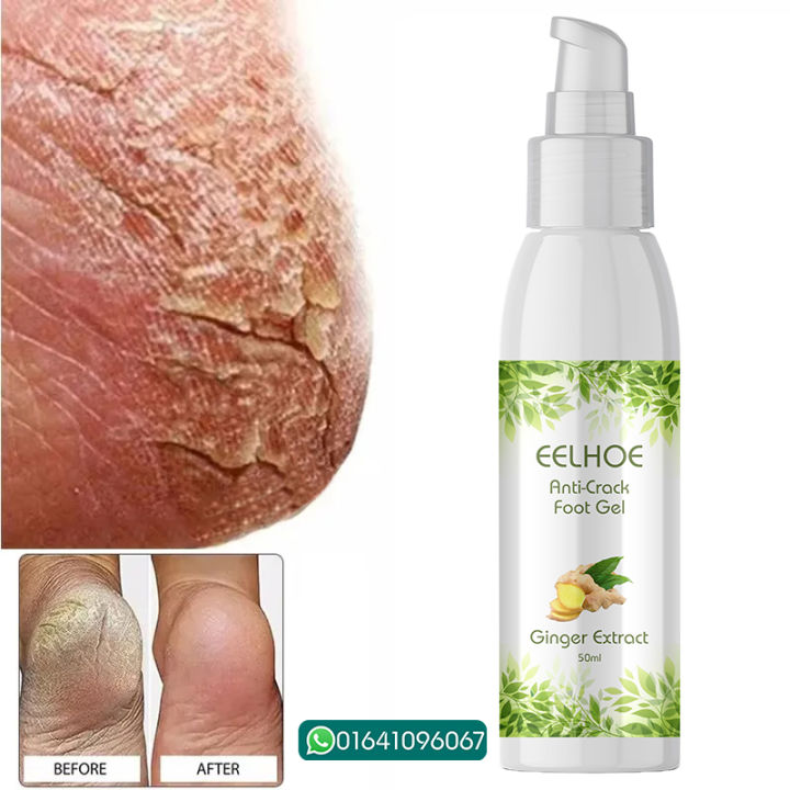 EELHOE%20Anti%20Crack%20Foot%20Hand%20Gel%20Ginger%20%20Cuticles%20Care%20Anti-Drying%20Healing%20Crack%20Frost%20Mask%20Dead%20Skin%20Removal%20Deep%20Moisturizing%20Feet%20Crack%20Whitening%20Smooth%20Feet%20Care%20-%20Image%203