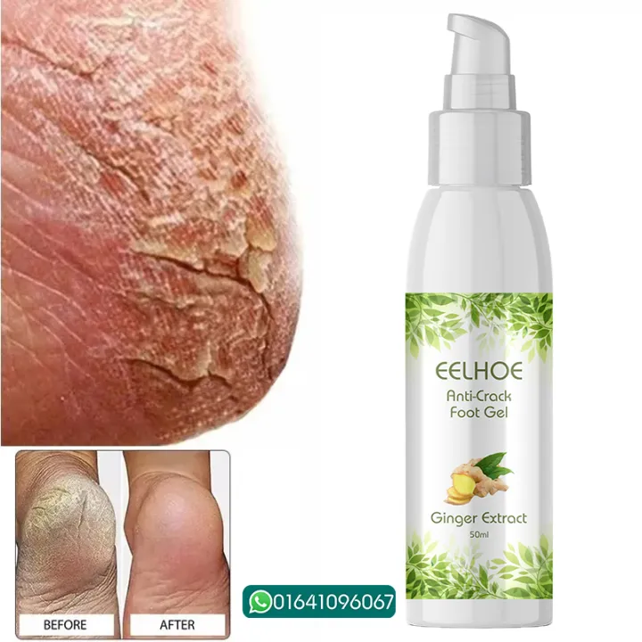 EELHOE%20Anti%20Crack%20Foot%20Hand%20Gel%20Ginger%20%20Cuticles%20Care%20Anti-Drying%20Healing%20Crack%20Frost%20Mask%20Dead%20Skin%20Removal%20Deep%20Moisturizing%20Feet%20Crack%20Whitening%20Smooth%20Feet%20Care%20-%20Image%204