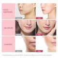 EMS Face Lifting Roller RF Double Chin V Face Shaped Facial Massager Jaw Cheek Thin Slimming Facial Lift Up Belt Skin Care Tool.