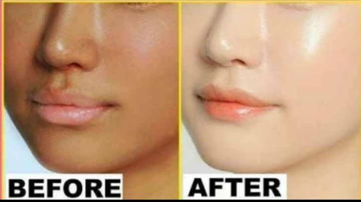 ACTIVE%20FAIRNES%20%20and%20Whaitening%20Night%20CREAM%20(%20%E0%A6%AC%E0%A6%BE%E0%A6%82%E0%A6%B2%E0%A6%BE%E0%A6%A6%E0%A7%87%E0%A6%B6%E0%A7%80%20)%20%20&%20One%20pcs%20/%20Fairness%20/%20Brone%20Out%20Face%20Wash%20Freee%20-%20Image%206