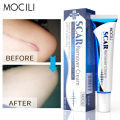 Acne Surgical Stretch Marks Removal Scar Cream Repair Smoothening Whitening Body Skin Care Pigmentation Beauty Cosmetics 20g AOutlierA. 