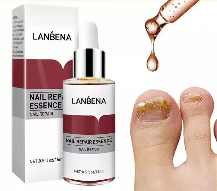 LANBENA%20Nail%20Repair%20Essence%20Serum%2015ml%20%E2%80%93%20Effective%20Nail%20Fungus%20&%20Damage%20-%20Image%202