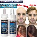 Kirkland Minoxidil 5% Topical Solution Extra Strength Beard & Hair Regrowth Treatment 60ml 1 Month Supply. 