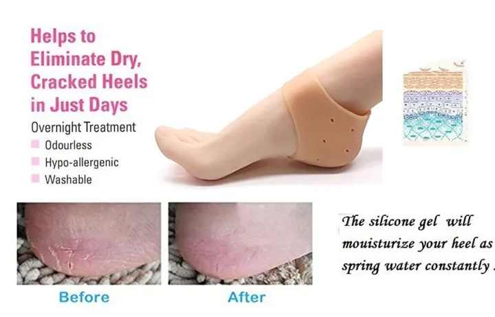 Silicone%20Heel%20Pad%20Anti%20Crack%20Set%20(Free%20Size)%202%20piceces%20-%20Image%207