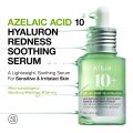 Anua Azelaic Acid 10 Hyaluron Redness Soothing Serum, Facial Serum for Sensitive skin, Hyaluronic Acid, Niacinamide, Spot Care, Natural Color, Vegan, Korean Skincare (30ml/ 1.01 fl oz.). 