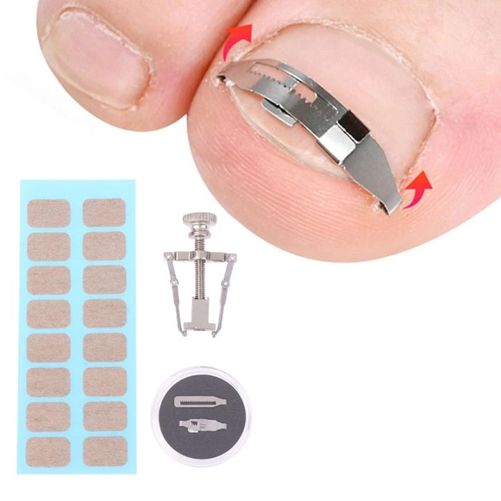 1 Set Ingrown Toenail Corrector Tools Pedicure Recover Embed Toe Nail Treatment Professional Foot Care Correction Tool