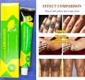 Lemonvate Cream - 30gm (Italy). 