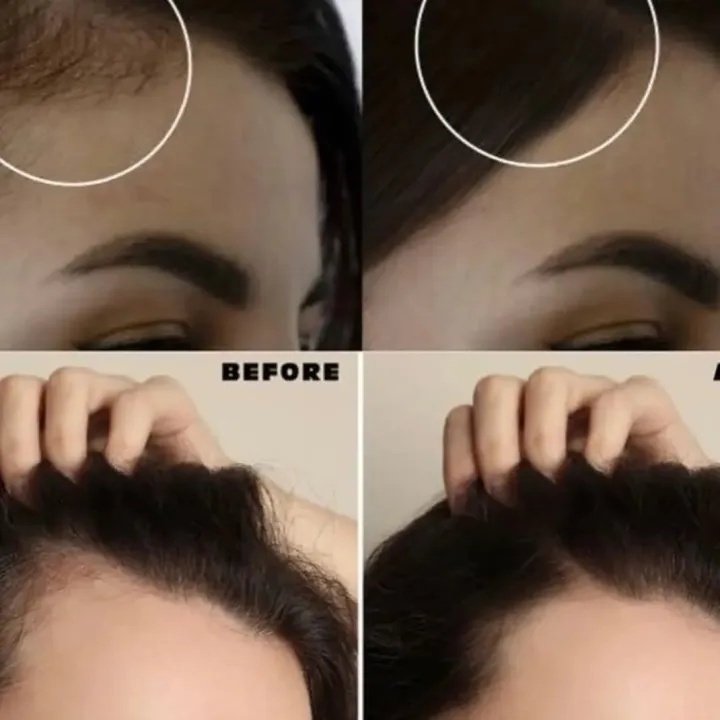 Mediflower%20Hair%20Tonic%20Anti%20Hair%20Loss%20-%20Image%205