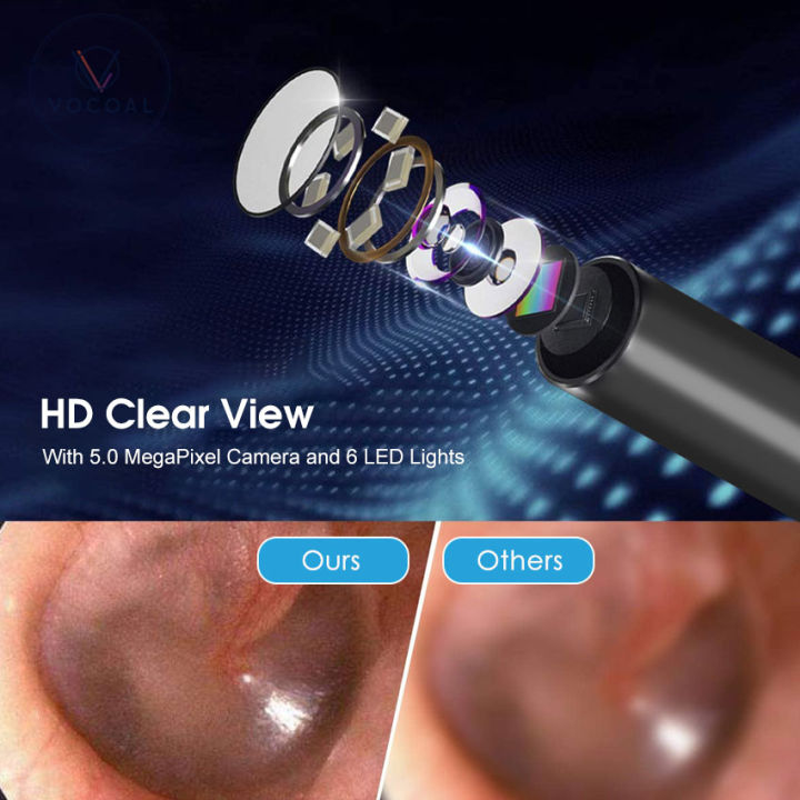 Vocoal%20Ear%20Pick%20Intelligent%20Visible%20Ear%20Spoon%20Ear%20Wax%20Removal%20Ear%20Cleaner%20with%20Camera%20Visual%20Ear%20Scope%20Camera%20Safe%20Ear%20Pick%20Ear%20Cleaning%20Endocsope%20Kit%20%20Wireless%20Ear%20Otoscope%20Ear%20Cleaning%20Tool%20for%20iPhone%20%20iPad%20&%20Android%20Smart%20Phones%20-%20Image%209