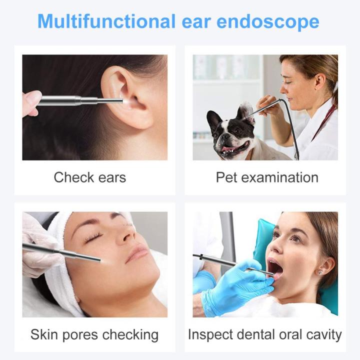3.9mm%20Otoscope%20Ent%20Inspection%20Camera%20Video%203%20in%201%20USB%20Visual%20Ear%20Cleaning%20Endoscope%20720P%20Medical%20Camera%20for%20Android%20Phone%20PC%20-%20Image%204
