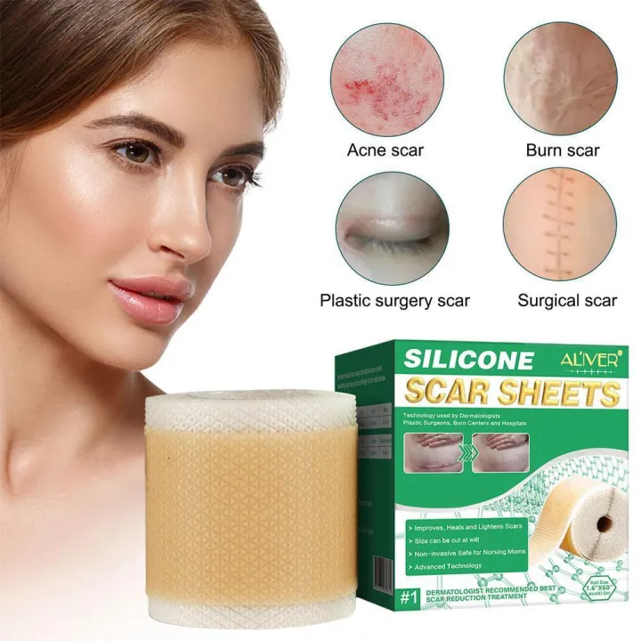 Silicone%20Scar%20Sheets%20Patch%20Painless%20Scar%20Repair%20Tape%20Roll%20Effective%20Scar%20Removal%20Strips%20For%20C-Section%20Keloid%20Surgery%20Burn%20A%20H8K5%20-%20Image%202