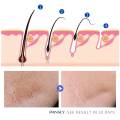 Natural Hair Inhibitor Cream Rapid Hair Removal Serum Painless Stop Hair Growth Mild Non-irritating Skin Care Body Beauty 50g. 