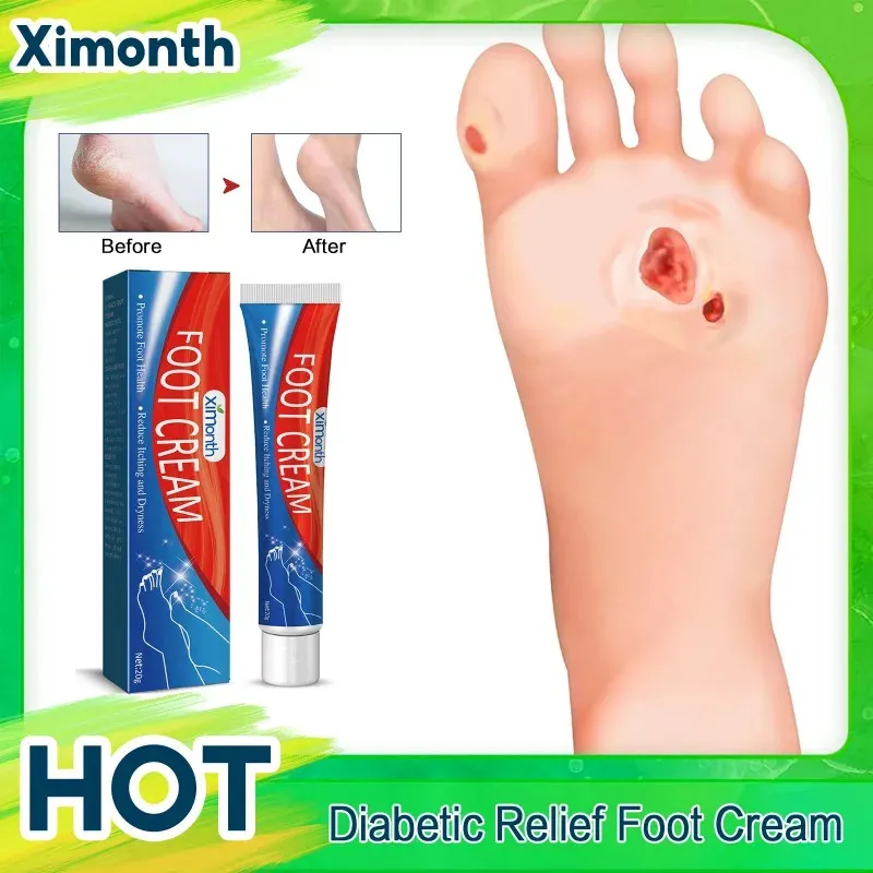 Blood Sugar Diabetes And Cracked Heels Diabetes Treatment Foot