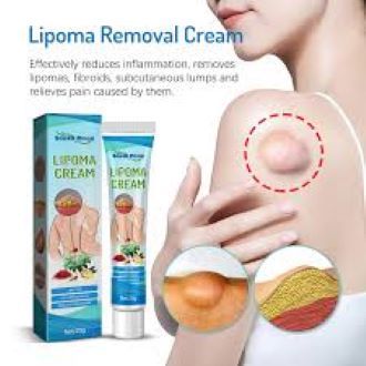 South%20Moon%20Lipoma%20Removal%20Cream%20Lipolysis%20Fat%20Lump%20Relieve%20Plaster%20Skin%20Swelling%20Ointment%20Subcutaneous%20Lumps%20Dredge%20Dissipate%20Body%20Care%EF%BC%8820g%EF%BC%89%20-%20Image%202