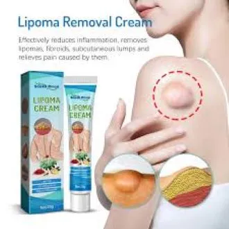 South%20Moon%20Lipoma%20Removal%20Cream%20Lipolysis%20Fat%20Lump%20Relieve%20Plaster%20Skin%20Swelling%20Ointment%20Subcutaneous%20Lumps%20Dredge%20Dissipate%20Body%20Care%EF%BC%8820g%EF%BC%89%20-%20Image%202