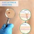 2-IN-1 Auto Skin Tag Removal Kit Painless Skin Label Mole Acne Wart Removal Pen Set with Cleansing Swabs Facial Beauty Care Tool.