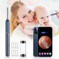 Ear Cleaning Camera Otoscope, Endoscope, 3 in 1 Ear Wax Removal. 