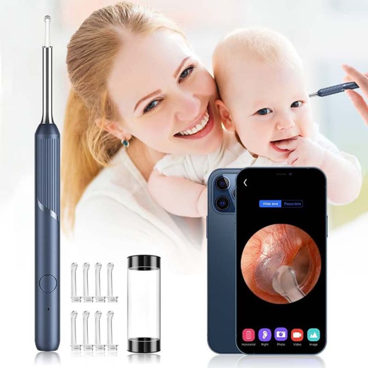 Ear%20Cleaning%20Camera%20Otoscope,%20Endoscope,%203%20in%201%20Ear%20Wax%20Removal%20-%20Image%203