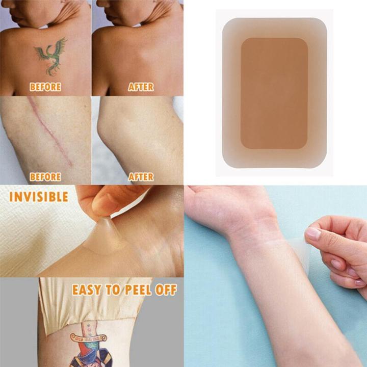 Tattoo%20Cover%20Up%20Sticker%20For%20Scar%20Birthmark%20Cover%20Up%20-%20Image%204