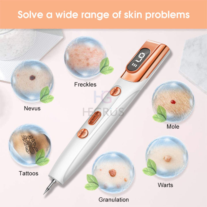 New%20HEGRU%20Mole%20Removal%20Pen%20kin%20Tag%20Remover%20pot%20Tattoo%20Freckle%20Removal%20Pen%20LED%20Lighting%20weep%20pot%20Mole%20Removing%20Dark%20pot%20Remover%20kin%20Care%209%20Adjutable%20Mode%20Laer%20Mole%20Pen%20-%20Image%206