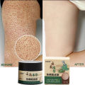 Coarse body hair, removal, cyst removal, Pila, good cream, keratosis, hairy chicken, skin condition, hole modification, dark spots, moisturizing, whitening, smooth skin care. 