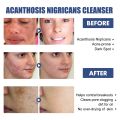 50ml Whitening Facial Cleanser Amino Acid Foam Scrub Cleansing Anti-Acne Oil Control Blackhead Remover Moisturizing Brightening. 