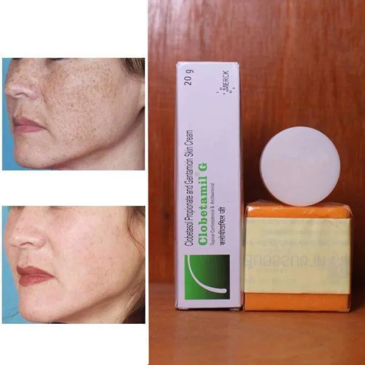3%20in%201%20Clobetamil%20G%20Skin%20Soap%20+%20Cream%20Set%20-%20Image%205