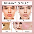HOYGI Collagen Jelly Skin Cream with COQ10 100g Deeply Moisturizes and Smoothes Fine-lines, Tightens skin giving wonderful brightening glow cream.. 