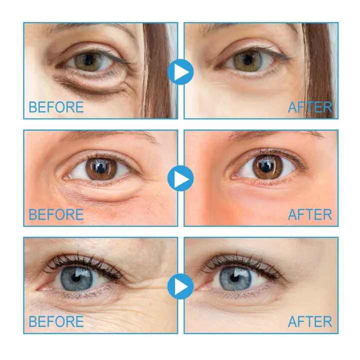 Caffeine%20eye%20cream%20reduces%20fine%20lines,%20moisturizes%20and%20repairs%20eye%20bags,%20tightens%20and%20moisturizes%20the%20skin%20around%20the%20eyes%20-%20Image%202